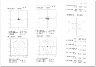 グラビコーダー（重心動揺計）